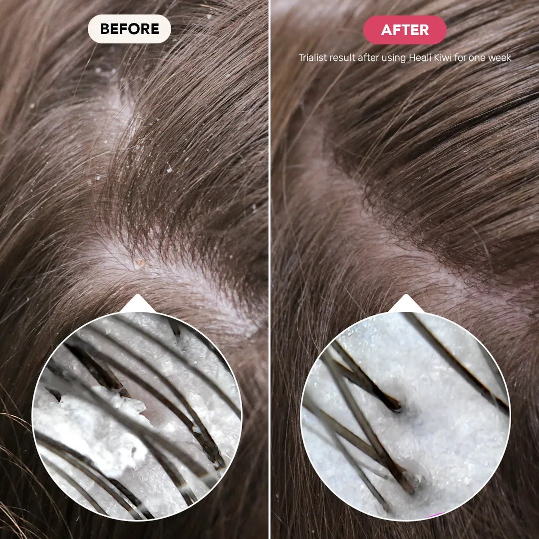 Calming Shampoo Bar Mini for Dry Scalps: Heali Kiwi™