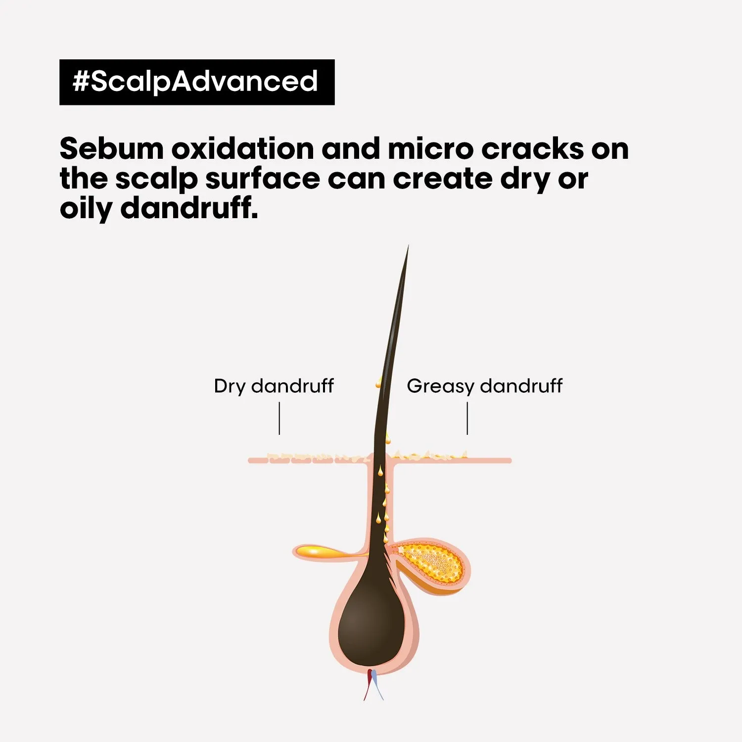 L'Oreal Professionnel Scalp Advanced Anti-Dandruff Dermo-Clarifier Shampoo 300ml